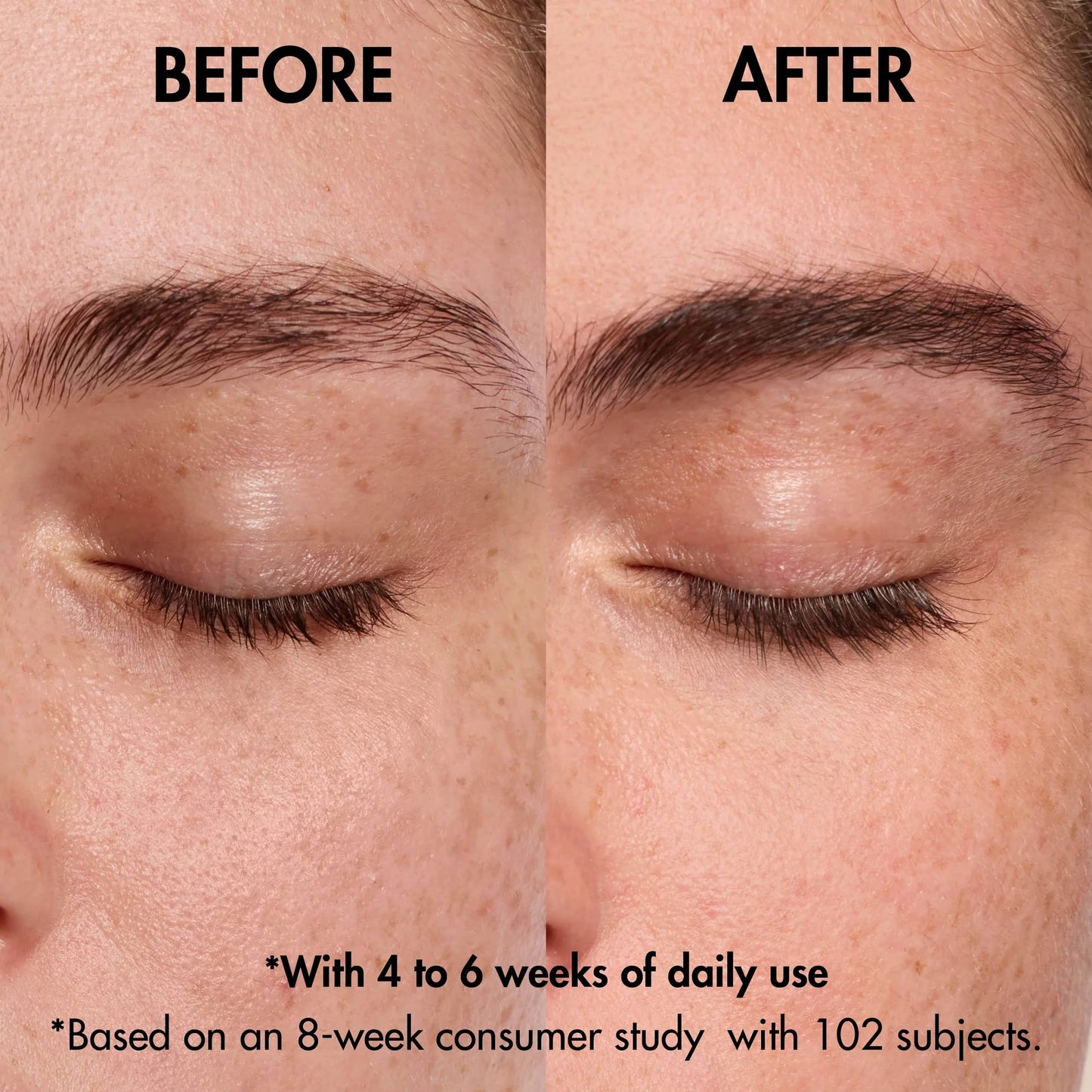 neuLASH® lash enhancing serum